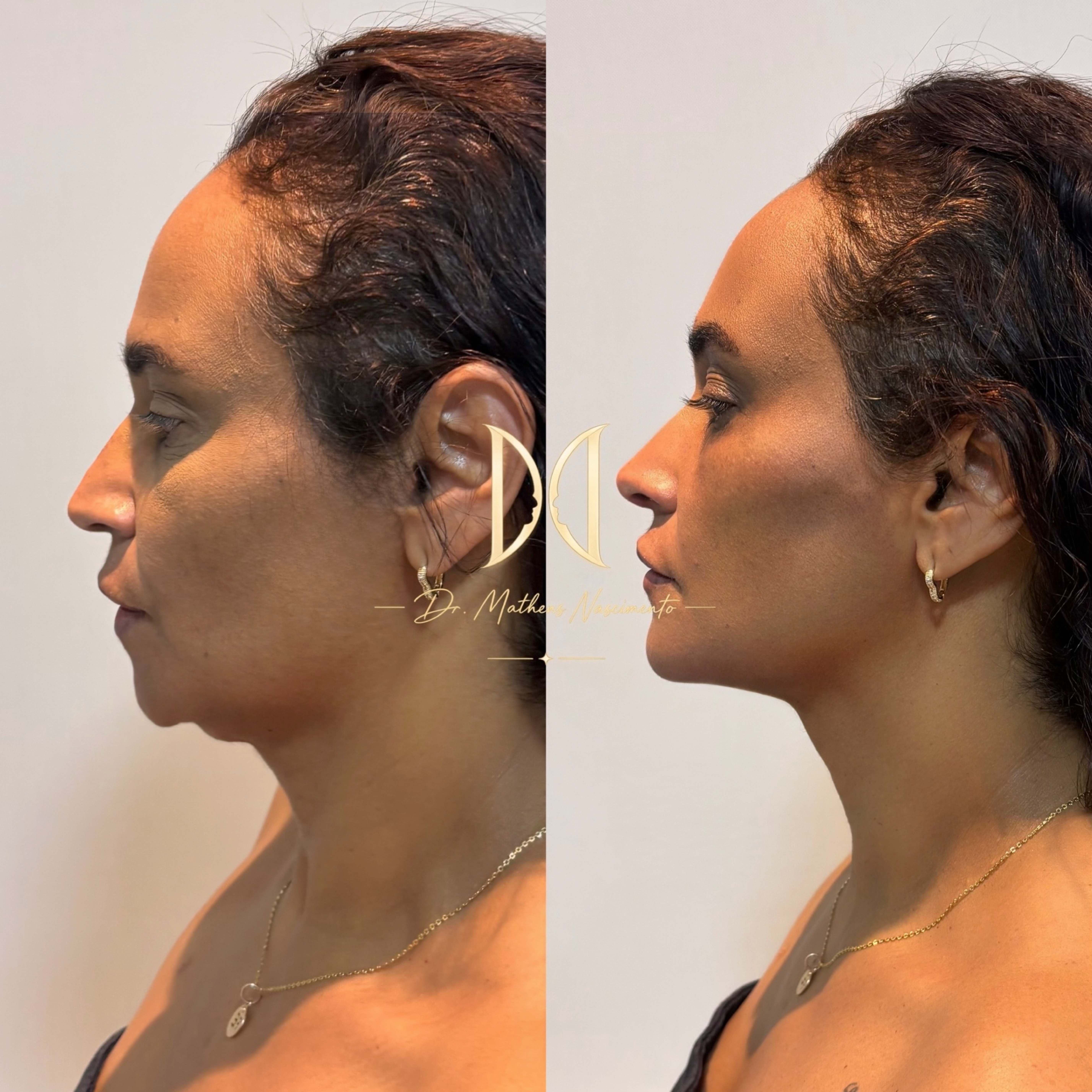 Face Restore Pro - Restauração Facial Especializada