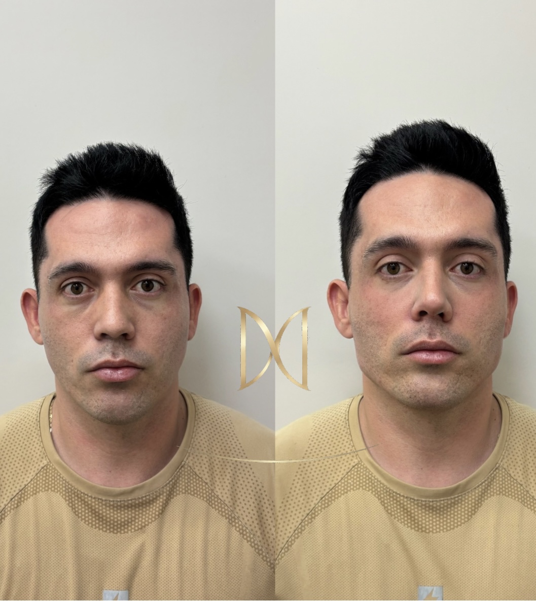 Full Face Masculino - Planejamento Estratégico